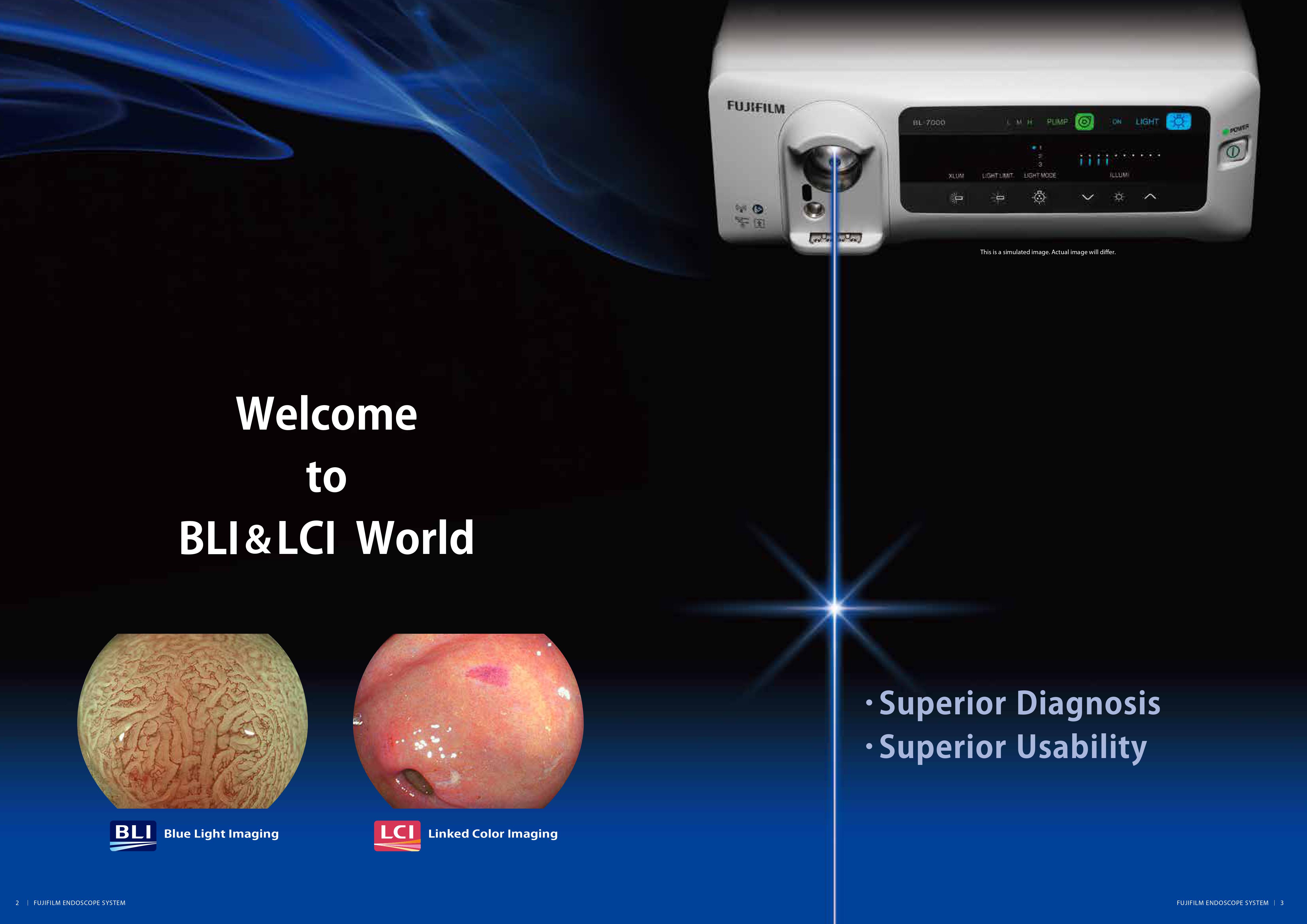 7000 SYSTEM | New Generation Endoscope System (Light Source / Video Processor)